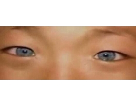 广西现神秘“猫眼男孩 ” 天生蓝瞳孔具有夜视能力